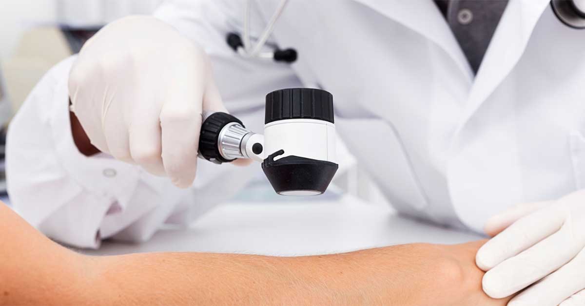 A GP uses a dermatoscope to assess patient's arm for signs of skin cancer